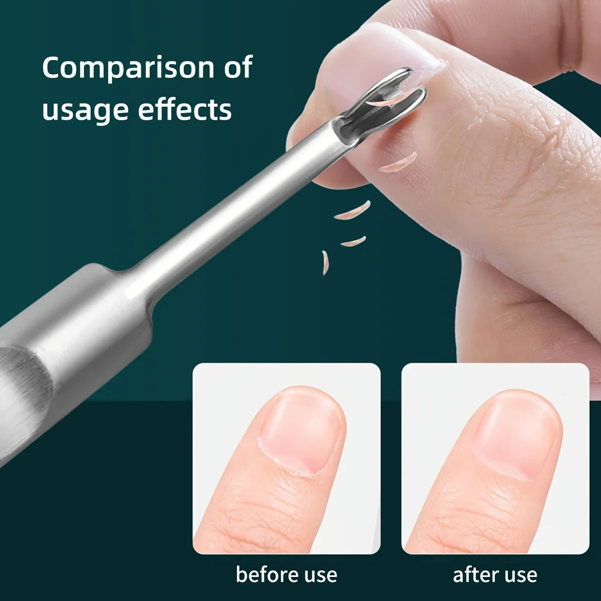 Stainless Steel Nail Polish Remover Set - Gel Peeler, Scraper & Cleaner Kit for Hands, Feet - Odorless Manicure & Pedicure Care